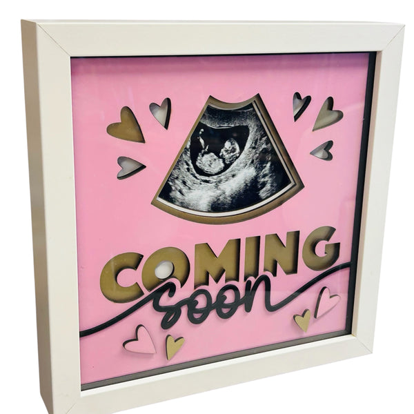Baby Scan 3D Boxed Frame – Keepsake Gift