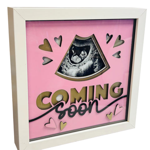 Baby Scan 3D Boxed Frame – Keepsake Gift