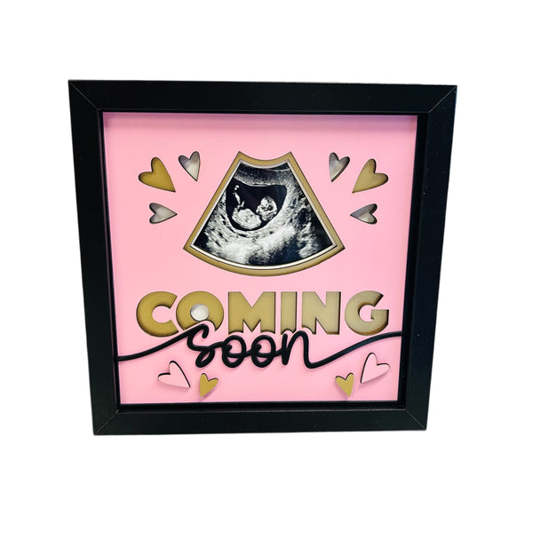 Baby Scan 3D Boxed Frame – Keepsake Gift